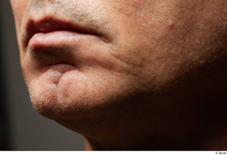 HD Face Skin Benito Romero chin face lips mouth scar skin pores skin texture 0001.jpg